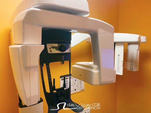 Imagen del escáner dental 3D en Granada