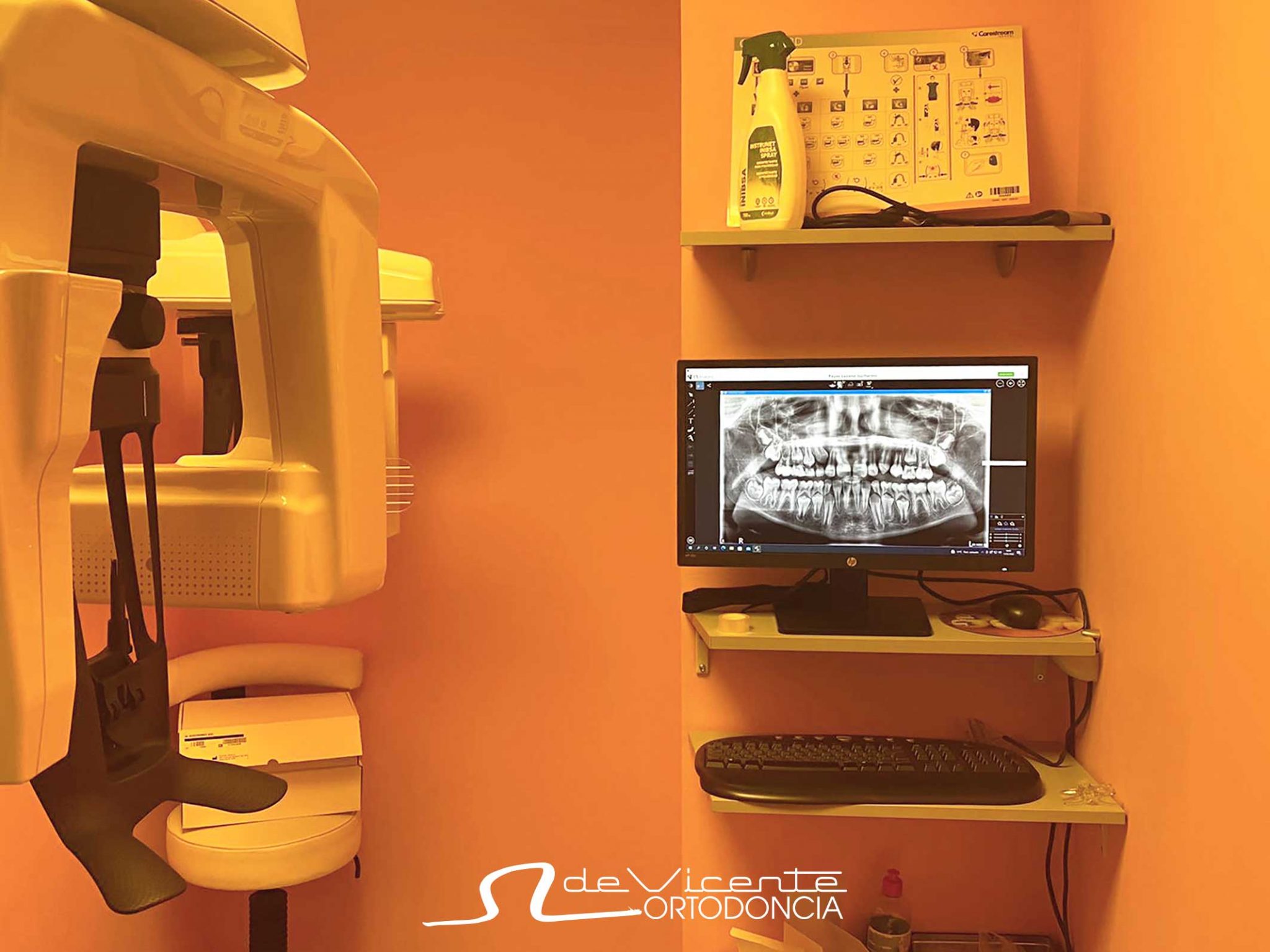 Radiografía Dental 3D Clínica Dental De Vicente Ortodoncia